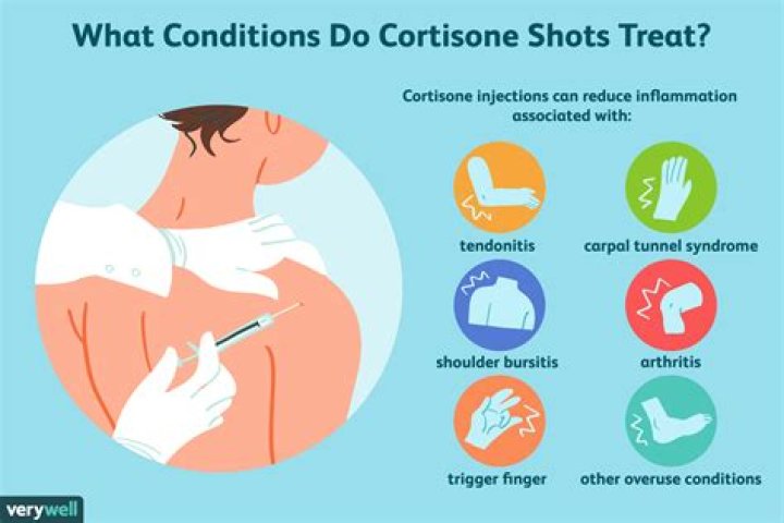 Cortisone Shots for Acne: Here's How It Works