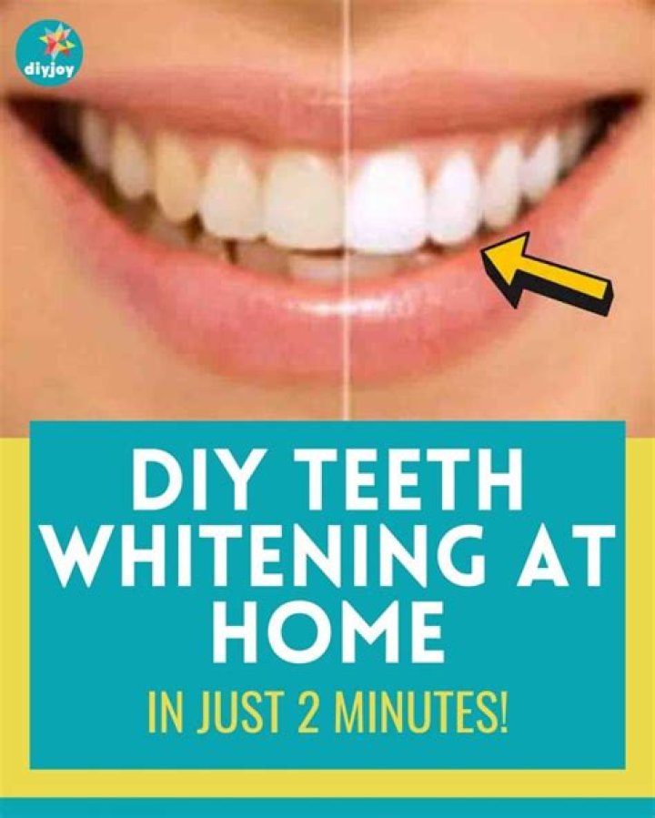 6 Natural Ways to Whiten Teeth at Home