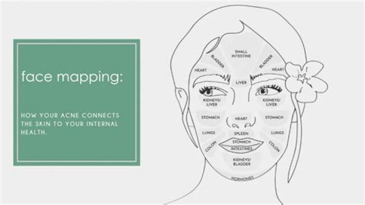 Can Your Breakouts Provide Clues to Your Health?