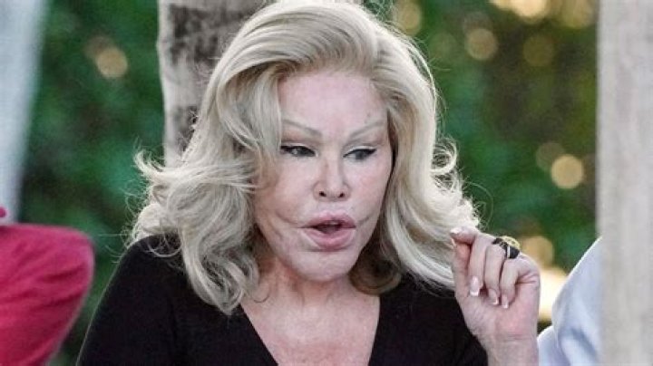 From Swiss Beauty to Plastic Surgery Disaster: Jocelyn Wildenstein