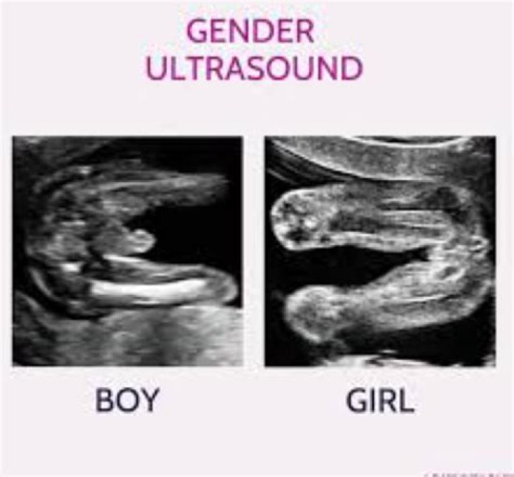How To Know Baby Gender Without Ultrasound