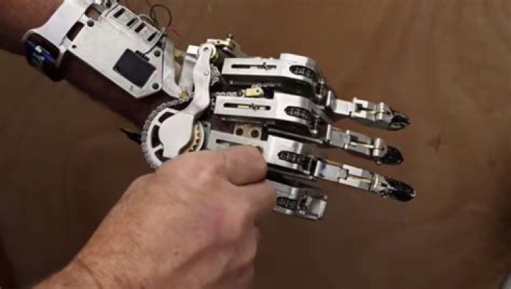 Man Gets Back Four Digits Of His Hand By Making Himself A Mechanical Arm – Which Makes Him A Cyborg
