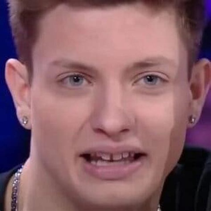 Matt Rife Teeth Before and After Venners Photos Are Adorable