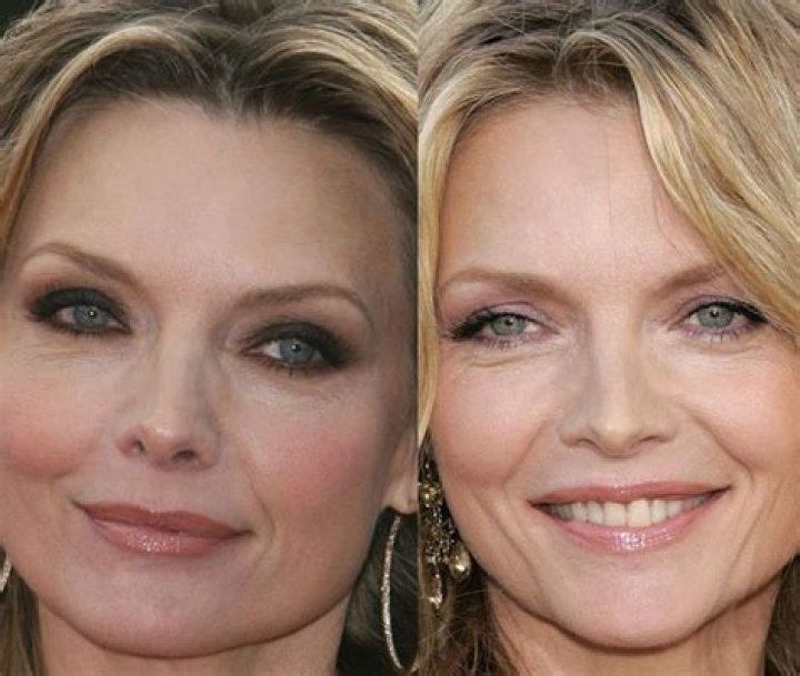 Michelle Pfeiffer Accepts Plastic Surgery and Reveals Her Plastic Surgery Rule